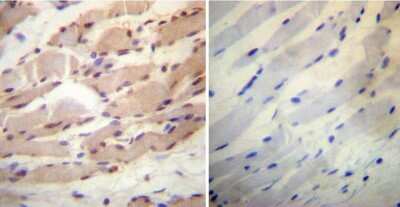 Immunohistochemistry-Paraffin: Cyclophilin 40 Antibody [NB120-3562] - Both normal and cancer biopsies of deparaffinized human Skeletal muscle tissue.