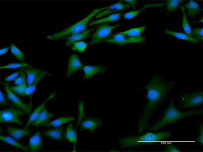 Immunocytochemistry/Immunofluorescence: Cyclophilin A Antibody [H00005478-D01P] - Analysis of antibody to PPIA on HeLa cell. Antibody concentration 20 ug/ml.