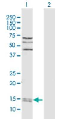 Western Blot: Cyclophilin A Antibody [H00005478-D01P] - Analysis of PPIA expression in transfected 293T cell line by PPIA polyclonal antibody.Lane 1: PPIA transfected lysate(18.00 KDa).Lane 2: Non-transfected lysate.