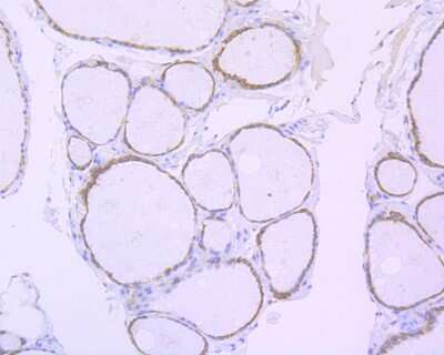Immunohistochemistry-Paraffin: Cyclophilin B Antibody (ST05-22) [NBP2-67529] - Immunohistochemical analysis of paraffin-embedded human thyroid tissue using anti-Cyclophilin B antibody. The section was pre-treated using heat mediated antigen retrieval with Tris-EDTA buffer (pH 8.0-8.4) for 20 minutes. The tissues were blocked in 5% BSA for 30 minutes at room temperature, washed with ddH2O and PBS, and then probed with the primary antibody (ET1609-58, 1/200) for 30 minutes at room temperature. The detection was performed using an HRP conjugated compact polymer system. DAB was used as the chromogen. Tissues were counterstained with hematoxylin and mounted with DPX.