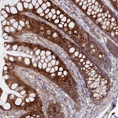 Immunohistochemistry-Paraffin Cyclophilin C Antibody - BSA Free