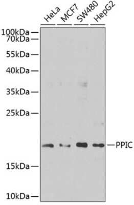 Western Blot: Cyclophilin C Antibody [NBP2-92841] - Analysis of extracts of various cell lines, using Cyclophilin C at 1:1000 dilution. Secondary antibody: HRP Goat Anti-Rabbit IgG (H+L) at 1:10000 dilution. Lysates/proteins: 25ug per lane. Blocking buffer: 3% nonfat dry milk in TBST. Detection: ECL Basic Kit . Exposure time: 30s.