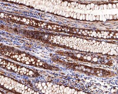 Immunohistochemistry-Paraffin: Cyclophilin-F Antibody (JM71-39) [NBP2-67014] - Analysis of paraffin-embedded human colon tissue with Rabbit anti-Cyclophilin F antibody washed with ddH2O and PBS, and then probed with the primary antibody  at 1/400 dilution for 1 hour at room temperature. The detection was performed using an HRP conjugated compact polymer system. DAB was used as the chromogen. Tissues were counterstained with hematoxylin and mounted with DPX.