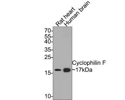 Western Blot: Cyclophilin-F Antibody (JM71-39) [NBP2-67014] - Analysis of Cyclophilin-F on different lysates with Rabbit anti-Cyclophilin-F antibody at 1/500 dilution. Lane 1: Rat heart tissue lysate Lane 2: Human brain tissue lysate Lysates/proteins at 20 ug/Lane. Predicted band size: 22 kDa Observed band size: 17 kDa Exposure time: 1 minute; 15% SDS-PAGE gel. Proteins were transferred to a PVDF membrane and blocked with 5% NFDM/TBST for 1 hour at room temperature. The primary antibody at 1/500 dilution was used in 5% NFDM/TBST at room temperature for 2 hours. Goat Anti-Rabbit IgG - HRP Secondary Antibody at 1:200,000 dilution was used for 1 hour at room temperature.