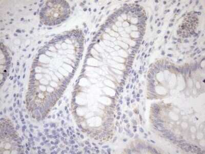 Immunohistochemistry: Cyclophilin-F Antibody (OTI1G8) - Azide and BSA Free [NBP2-71551] - Analysis of Human colon tissue. (Heat-induced epitope retrieval by 1mM EDTA in 10mM Tris buffer (pH8.5) at 120C for 3 min)