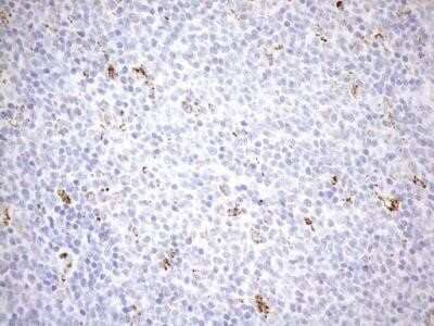 Immunohistochemistry: Cyclophilin-F Antibody (OTI1G8) - Azide and BSA Free [NBP2-71551] - Analysis of Human lymphoma tissue using PPIF mouse monoclonal antibody.(Heat-induced epitope retrieval by 1mM EDTA in 10mM Tris buffer (pH8.5) at 120C for 3 min)