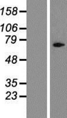 Western Blot: Cylicin 1 Overexpression Lysate (Adult Normal) [NBP2-06565] Left-Empty vector transfected control cell lysate (HEK293 cell lysate); Right -Over-expression Lysate for Cylicin 1.
