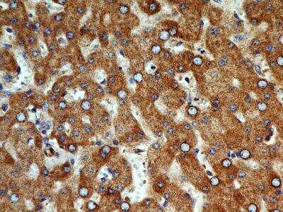 Immunohistochemistry-Paraffin: Cyr61/CCN1 Antibody (3A7.1B8) [NBP2-36490] - IHC analysis of formalin-fixed paraffin-embedded tissue section of human liver using Cyr61/CCN1 antibody (clone 3A7.1B8) at 5 ug/ml concentration. The hepatocytes generated a specific cytoplasmic staining with no signal in the cellular nuclei or the sinusoids.