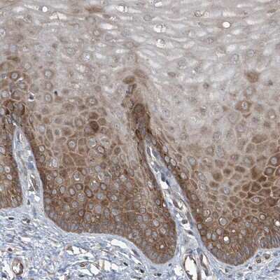 Immunohistochemistry-Paraffin: Cyr61/CCN1 Antibody [NBP1-86573] - Staining of human cervix, uterine shows cytoplasmic positivity in squamous epithelial cells.