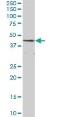 Western Blot: Cystathionase Antibody [H00001491-B01P] - Analysis of CTH expression in human liver.