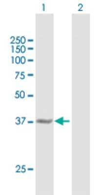 Western Blot: Cystathionase Antibody [H00001491-B01P] - Analysis of CTH expression in transfected 293T cell line by CTH polyclonal antibody.  Lane 1: CTH transfected lysate(44.55 KDa). Lane 2: Non-transfected lysate.