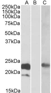 Western Blot Cystatin-8 Antibody