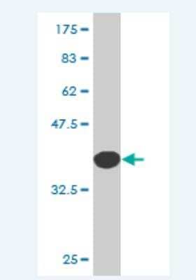 Western Blot: Cystatin A Antibody (1A11) [H00001475-M01] - Detection against Immunogen (36.52 KDa)