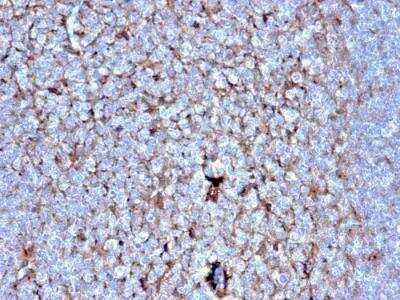 Immunohistochemistry-Paraffin: Cystatin A Antibody (CSTA/2882) - Azide and BSA Free [NBP2-79882] - Formalin-fixed, paraffin-embedded human Tonsil stained with Cystatin A Mouse Monoclonal Antibody (CSTA/2882).