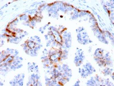 Immunohistochemistry-Paraffin: Cystatin A Antibody (CSTA/2882) - Azide and BSA Free [NBP2-79882] - Formalin-fixed, paraffin-embedded human Prostate stained with Cystatin A Mouse Monoclonal Antibody (CSTA/2882).
