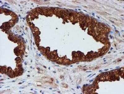 Immunohistochemistry: Cystatin C Antibody (OTI2C8) - Azide and BSA Free [NBP2-70472] - Staining of paraffin-embedded Carcinoma of Human prostate tissue using anti-Cystatin C mouse monoclonal antibody.