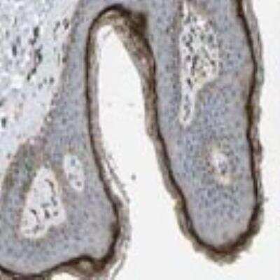 Immunohistochemistry: Cystatin E/M/CST6 Antibody [28730002] - Most of the normal tissues displayed weak to moderate cytoplasmic positivity. Strong staining was observed in a fraction of cells in renal tubules and in stratum granulosum of squamous epithelia. Liver and urothelial cells were mainly negative. Malignant tissues generally exhibited similar staining properties as normal cells. Occasional cases of renal cancers showed strong nuclear immunoreactivity. Most malignant lymphomas, prostate and hepatocellular cancers were negative.  Image and statement courtesy of the Human Protein Atlas (HPA).