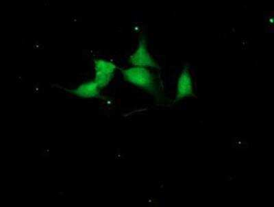 Immunocytochemistry/Immunofluorescence: Cystatin S Antibody (2H10) [NBP2-01656] - Immunofluorescent staining of HeLa cells using anti-Cystatin S mouse monoclonal antibody.