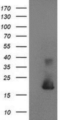 Western Blot: Cystatin S Antibody (2H10) [NBP2-01656] - HEK293T cells were transfected with the pCMV6-ENTRY control (Left lane) or pCMV6-ENTRY Cystatin S (Right lane) cDNA for 48 hrs and lysed. Equivalent amounts of cell lysates (5 ug per lane) were separated by SDS-PAGE and immunoblotted with anti-Cystatin S.