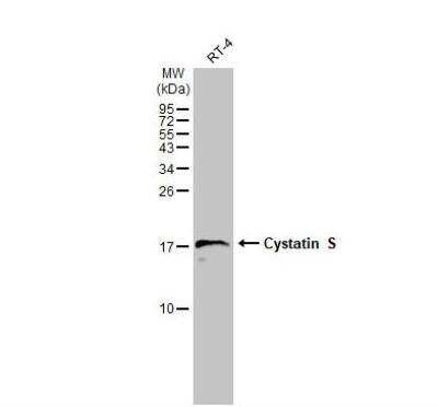 Western Blot: Cystatin S Antibody [NBP1-32996] - Whole cell extract (30 ug) was separated by 15% SDS-PAGE, and the membrane was blotted with Cystatin S antibody [N1N3] diluted at 1:1000. The HRP-conjugated anti-rabbit IgG antibody (NBP2-19301) was used to detect the primary antibody.