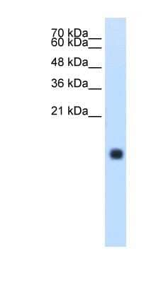 Western Blot: Cystatin S Antibody [NBP1-57919] - HepG2 cell lysate, concentration 1.25ug/ml.