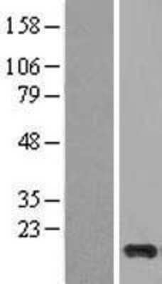 Western Blot: Cystatin S Overexpression Lysate (Adult Normal) [NBL1-09547] Left-Empty vector transfected control cell lysate (HEK293 cell lysate); Right -Over-expression Lysate for Cystatin S.