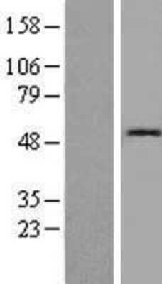 Western Blot: Cystatin SN Overexpression Lysate (Adult Normal) [NBP2-10786] Left-Empty vector transfected control cell lysate (HEK293 cell lysate); Right -Over-expression Lysate for Cystatin SN.