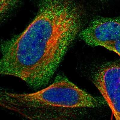 Immunocytochemistry/ Immunofluorescence Cysteine Conjugate beta-Lyase/CCBL1 Antibody - BSA Free