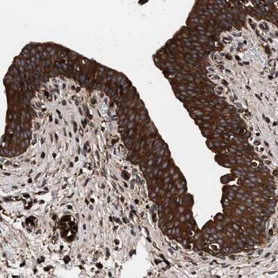 Immunohistochemistry-Paraffin: Cysteine Conjugate beta-Lyase/CCBL1 Antibody [NBP1-83316] - Staining of human urinary bladder shows strong positivity in urothelial cells.