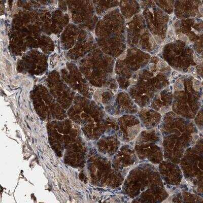 Immunohistochemistry-Paraffin: Cysteine Conjugate beta-Lyase/CCBL1 Antibody [NBP1-83317] - Staining of human stomach shows strong cytoplasmic positivity in glandular cells.