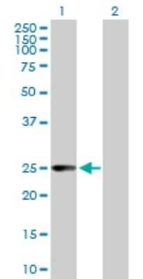 Western Blot: Cysteine Conjugate beta-Lyase/CCBL1 Antibody [H00000883-B02P] - Analysis of CCBL1 expression in transfected 293T cell line by CCBL1 polyclonal antibody.  Lane1:CCBL1 transfected lysate(27.5 KDa). Lane2:Non-transfected lysate.