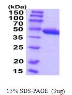 SDS-Page: Cysteine Conjugate beta-Lyase/CCBL1 Recombinant Protein [NBP2-52105] - 15% SDS Page (3 ug)