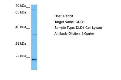 Western Blot: Cysteine Dioxygenase Type 1 Antibody [NBP2-87241] - Host: Rabbit. Target Name: CDO1. Sample Tissue: Human DLD1 Whole Cell lysates. Antibody Dilution: 1ug/ml