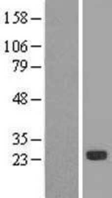 Western Blot: Cysteine Dioxygenase Type 1 Overexpression Lysate (Adult Normal) [NBL1-09058] Left-Empty vector transfected control cell lysate (HEK293 cell lysate); Right -Over-expression Lysate for Cysteine Dioxygenase Type 1.