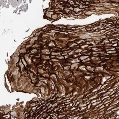 Immunohistochemistry-Paraffin: Cysteine Rich Tail 1 Antibody [NBP1-81057] - Staining of human esophagus shows strong cytoplasmic and membranous positivity in squamous epithelial cells.