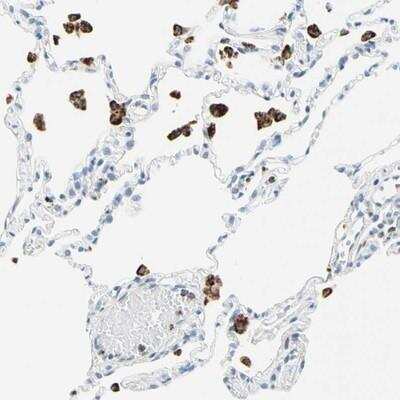 Immunohistochemistry-Paraffin: Cysteinyl Leukotriene R1/CysLTR1 Antibody [NBP1-85356] - Staining of human lung shows strong cytoplasmic positivity in macrophages.