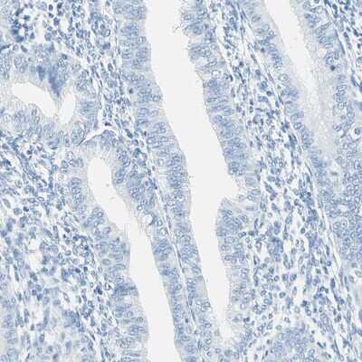 Immunohistochemistry-Paraffin Cysteinyl Leukotriene R1/CysLTR1 Antibody