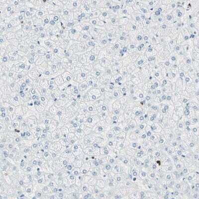 Immunohistochemistry-Paraffin Cysteinyl Leukotriene R1/CysLTR1 Antibody