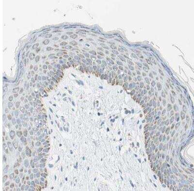 Immunohistochemistry-Paraffin Cysteinyl Leukotriene R1/CysLTR1 Antibody