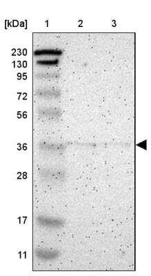 Western Blot: Cysteinyl Leukotriene R1/CysLTR1 Antibody [NBP1-85356] - Lane 1: Marker  [kDa] 230, 130, 95, 72, 56, 36, 28, 17, 11.  Lane 2: Human cell line RT-4.  Lane 3: Human cell line U-251MG sp