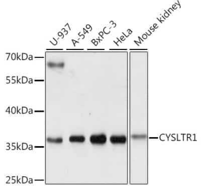 Western Blot Cysteinyl Leukotriene R1/CysLTR1 Antibody - Azide and BSA Free