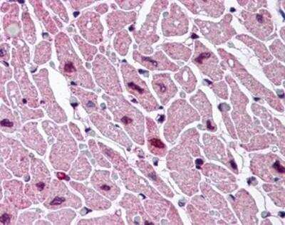 Immunohistochemistry-Paraffin: Cysteinyl Leukotriene R2/CysLTR2 Antibody [NBP1-02650] - Staining of human heart. Immunohistochemistry of formalin-fixed, paraffin-embedded tissue after heat-induced antigen retrieval. Antibody concentration 10 ug/ml.