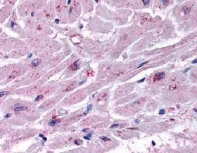 Immunohistochemistry-Paraffin: Cysteinyl Leukotriene R2/CysLTR2 Antibody [NLS3305] - IHC staining of human heart.