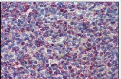 Immunohistochemistry-Paraffin: Cysteinyl Leukotriene R2/CysLTR2 Antibody [NLS3305] - IHC staining of human spleen.