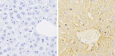 Immunohistochemistry-Paraffin: Cytochrome P450 1A1/1A2 Antibody (MC1) [NB100-74398] - Analysis showing staining in the cytoplasm and membrane of rat liver tissue (right) compared with a negative control without primary antibody (left).