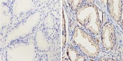 Immunohistochemistry-Paraffin: Cytochrome P450 1A1/1A2 Antibody (MC1) [NB100-74398] - Analysis showing positive staining in the membrane of Human prostate tissue (right) compared with a negative control in the absence of primary antibody (left).