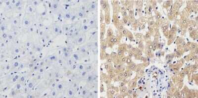 Immunohistochemistry-Paraffin: Cytochrome P450 1A1/1A2 Antibody (MC1) [NB100-74398] - Analysis showing positive staining in the cytoplasm and membrane of Human liver tissue (right) compared with a negative control in the absence of primary antibody (left).