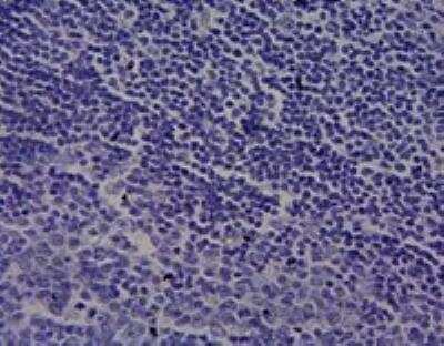 Immunohistochemistry-Paraffin: Cytochrome P450 1A1 Antibody [NBP1-97762] - Negative Control showing staining of paraffin embedded Human Tonsil, with no primary antibody.