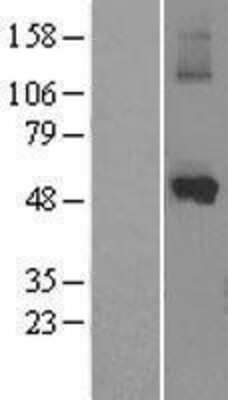 Western Blot: Cytochrome P450 1A1 Overexpression Lysate (Adult Normal) [NBL1-09675] Left-Empty vector transfected control cell lysate (HEK293 cell lysate); Right -Over-expression Lysate for Cytochrome P450 1A1.