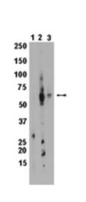 Western Blot: Cytochrome P450 1A2 Antibody (1A2) [NBP2-29707] - Figure shows a wetern blot using Normal Mouse IgG at 1/500 (lane 1) and using mouse anti-rat CytochromeP450 CyP 1A2 at 1:100 (lane 2) and 1:1000 (lane 3) on samples from PC12 cells.